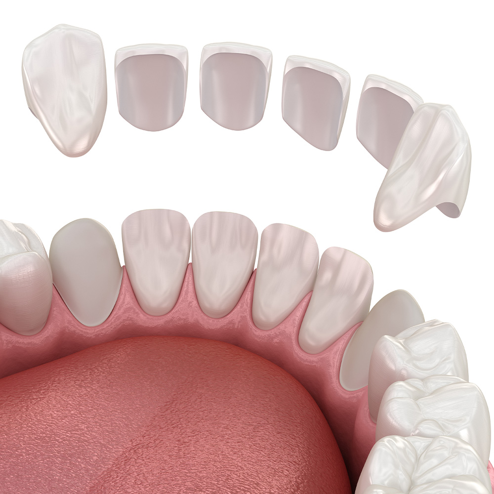 Cosmetic dentistry from Elonix