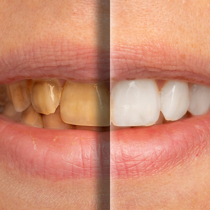 Is Cosmetic Dentistry Right for You?