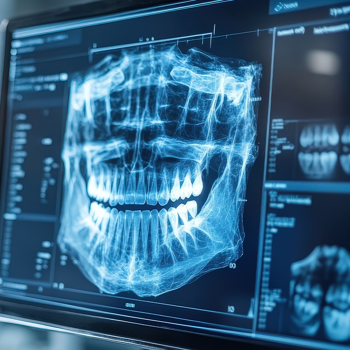 Full Mouth Dental Reconstruction - Best Prices for Dental Tourism in Tirana Albania