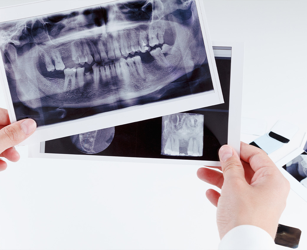 our-approach-dental-reconstruction-elonix The Elonix approach to dental reconstruction